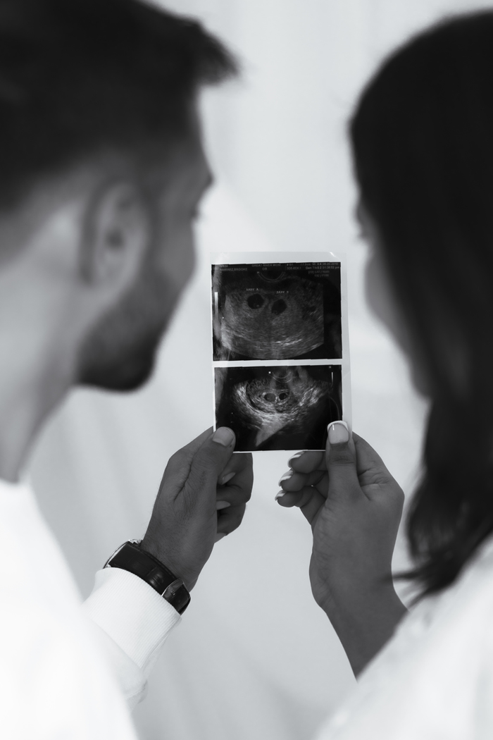 Black and white maternity photography ultrasound